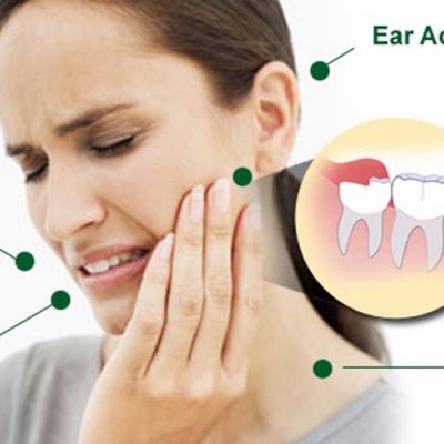 impacted-wisdom-teeth-pain-copy