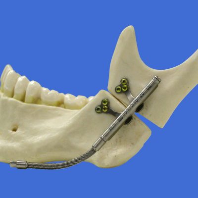 mandible