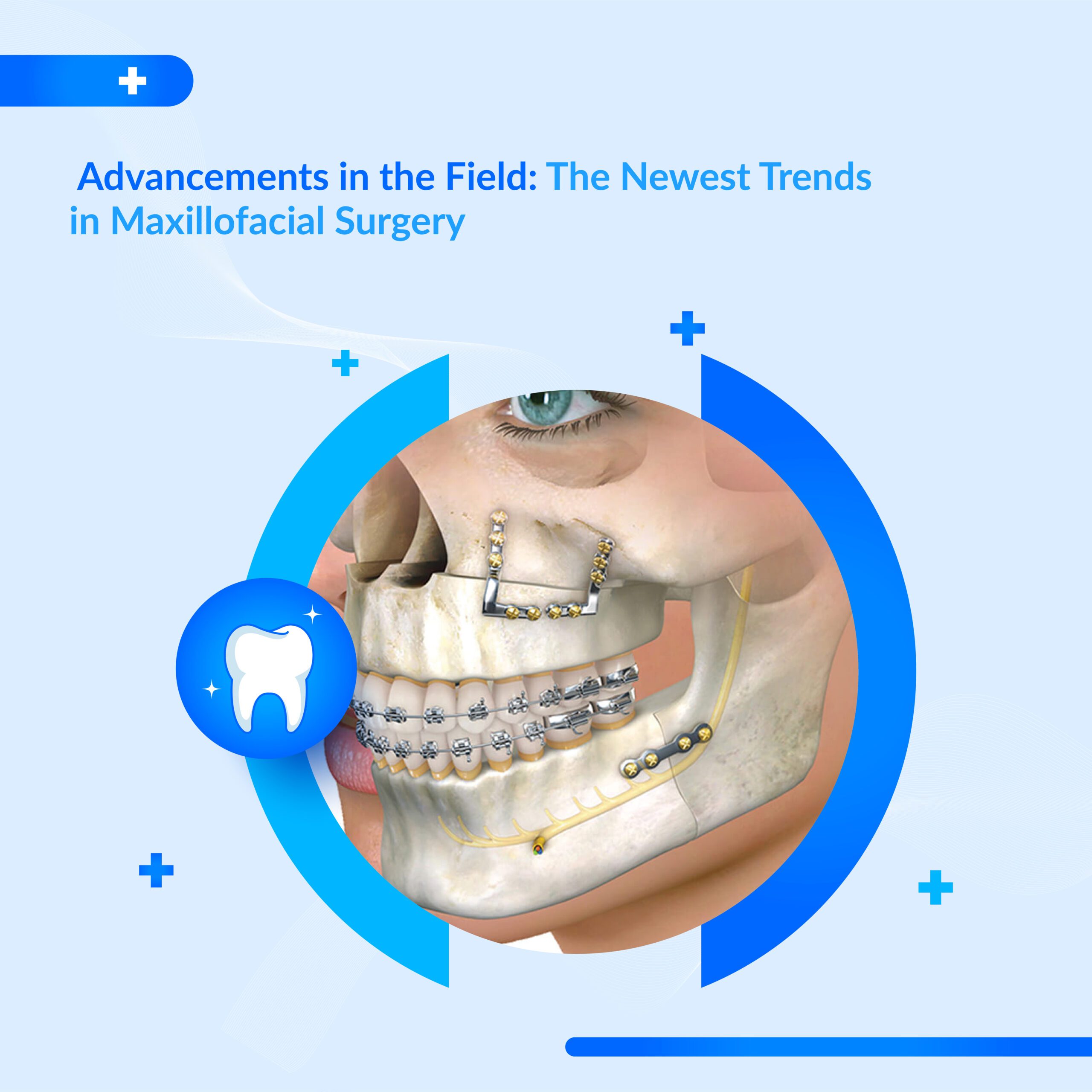 Latest Trends in Maxillofacial Surgery Techniques
