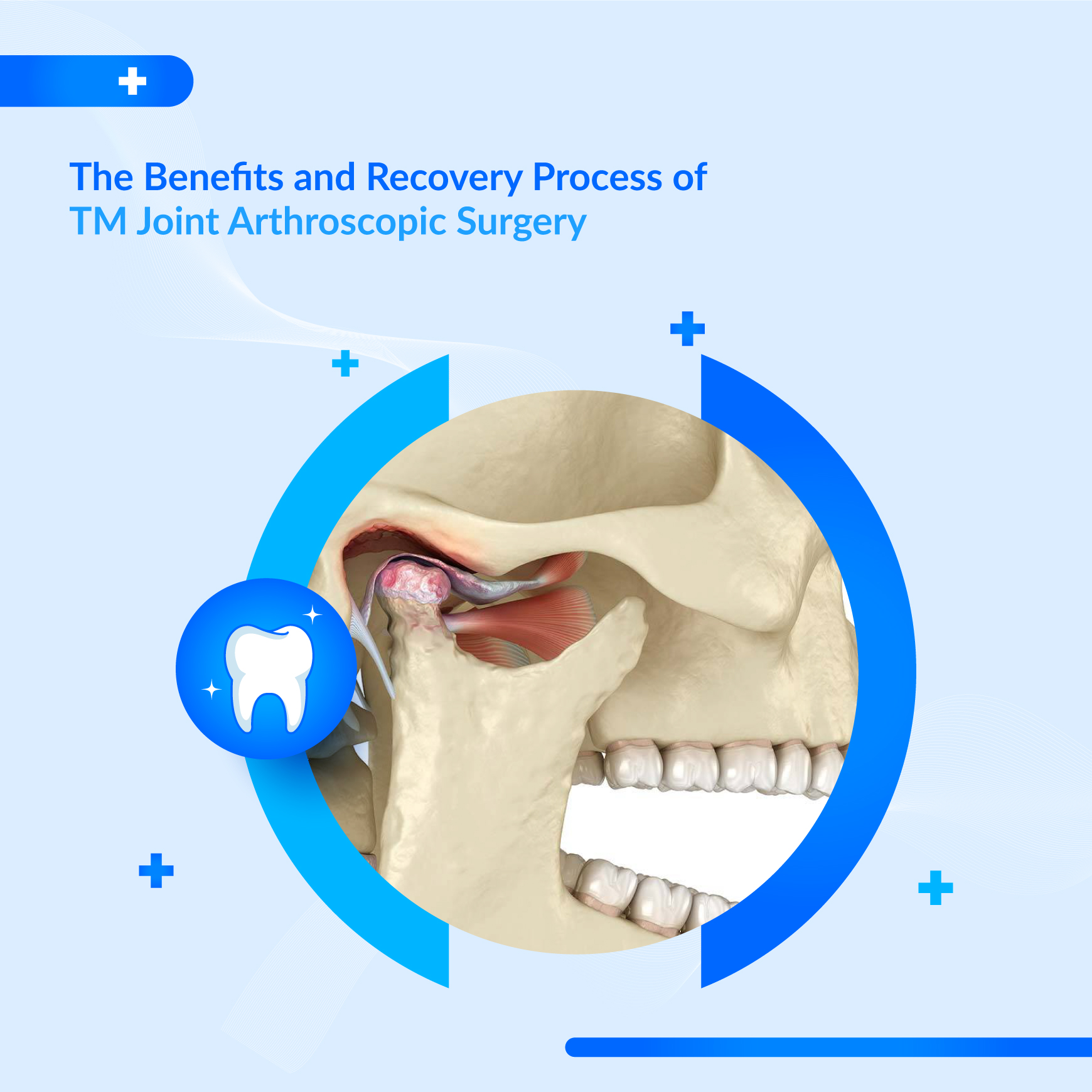 TMJ Disorder Treatments