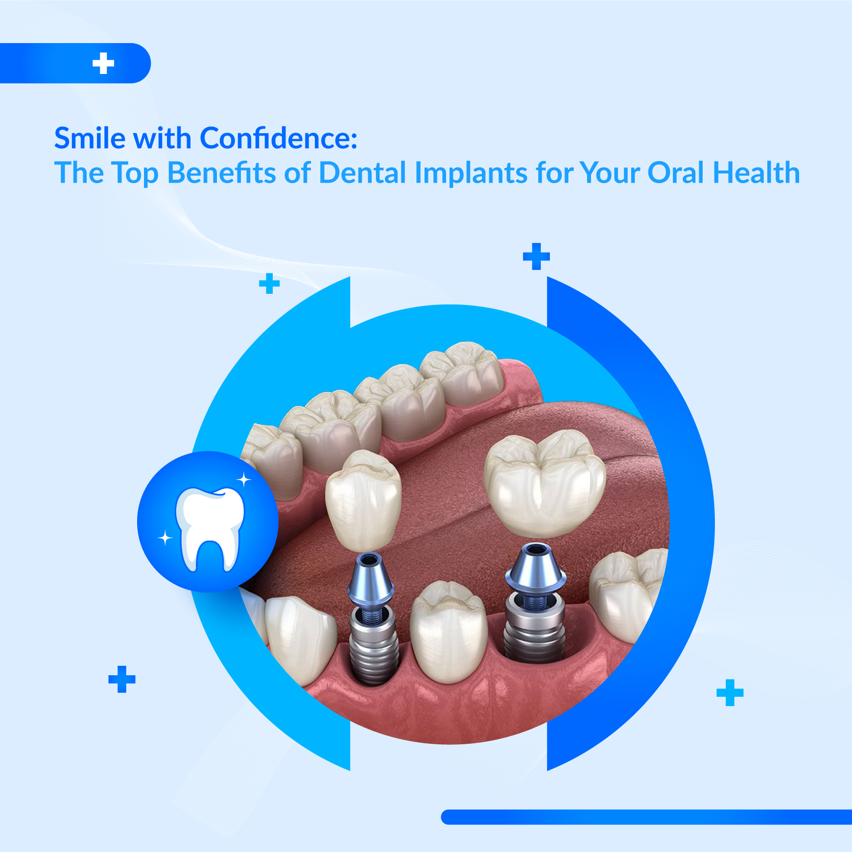 Minor Oral Surgery Specialist UAE