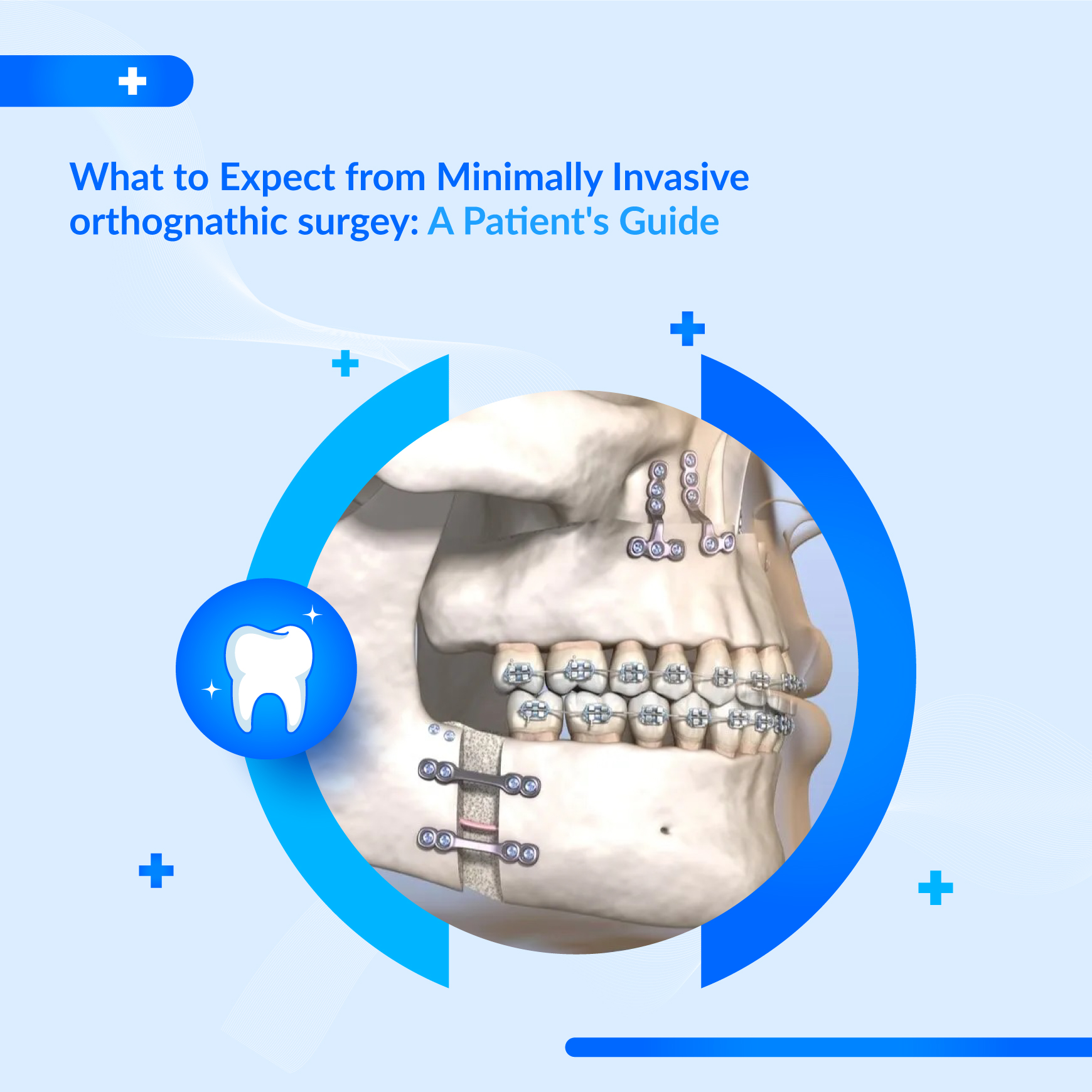 Jaw Joint Discomfort