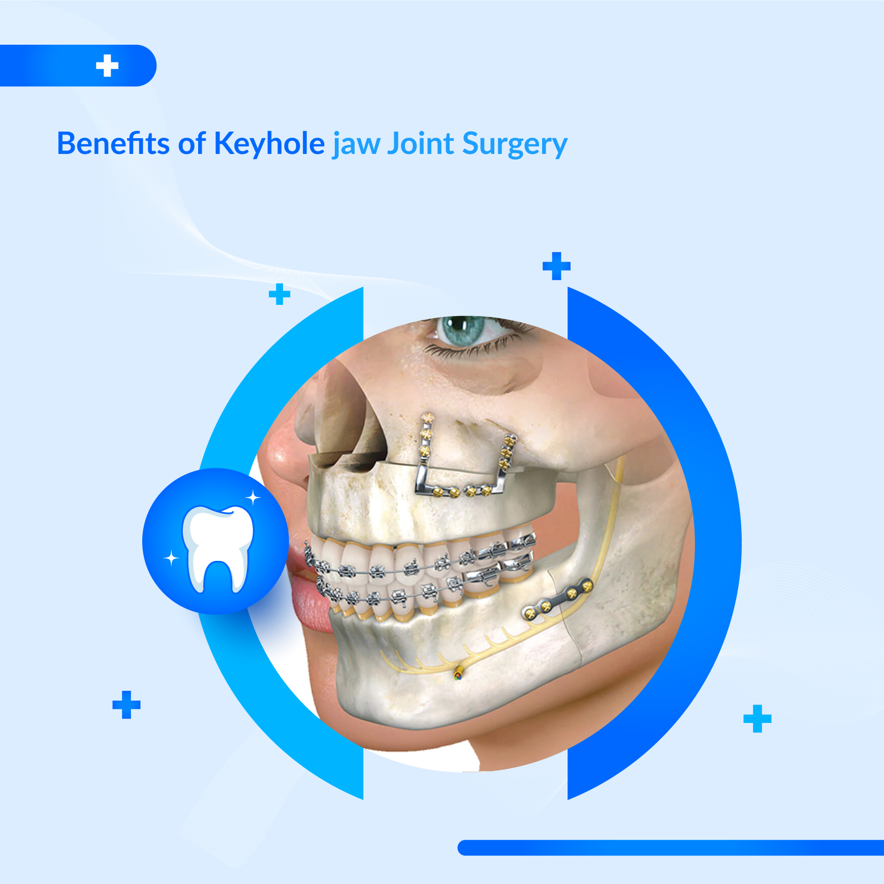 Orthognathic Jaw Surgery UAE