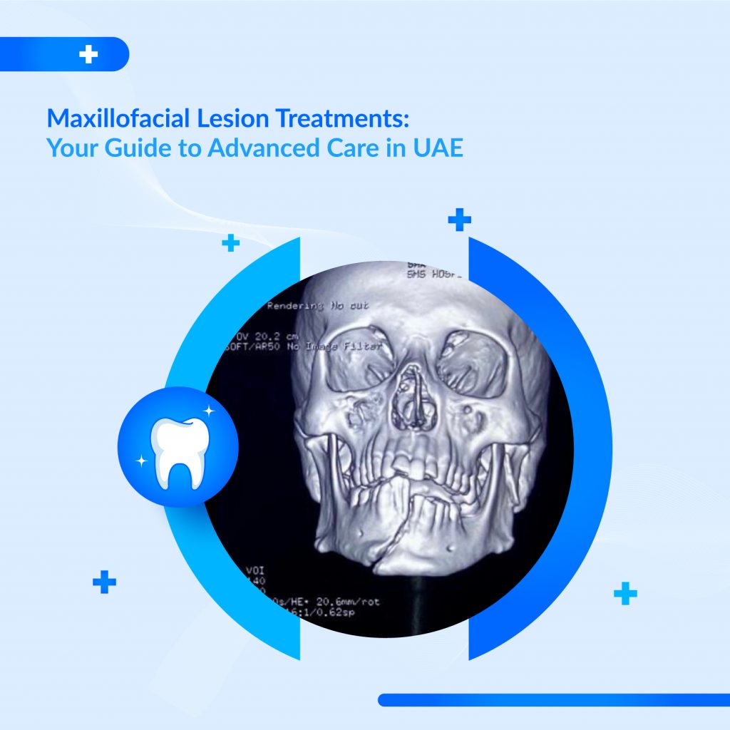 Maxillofacial Tumor Specialist UAE