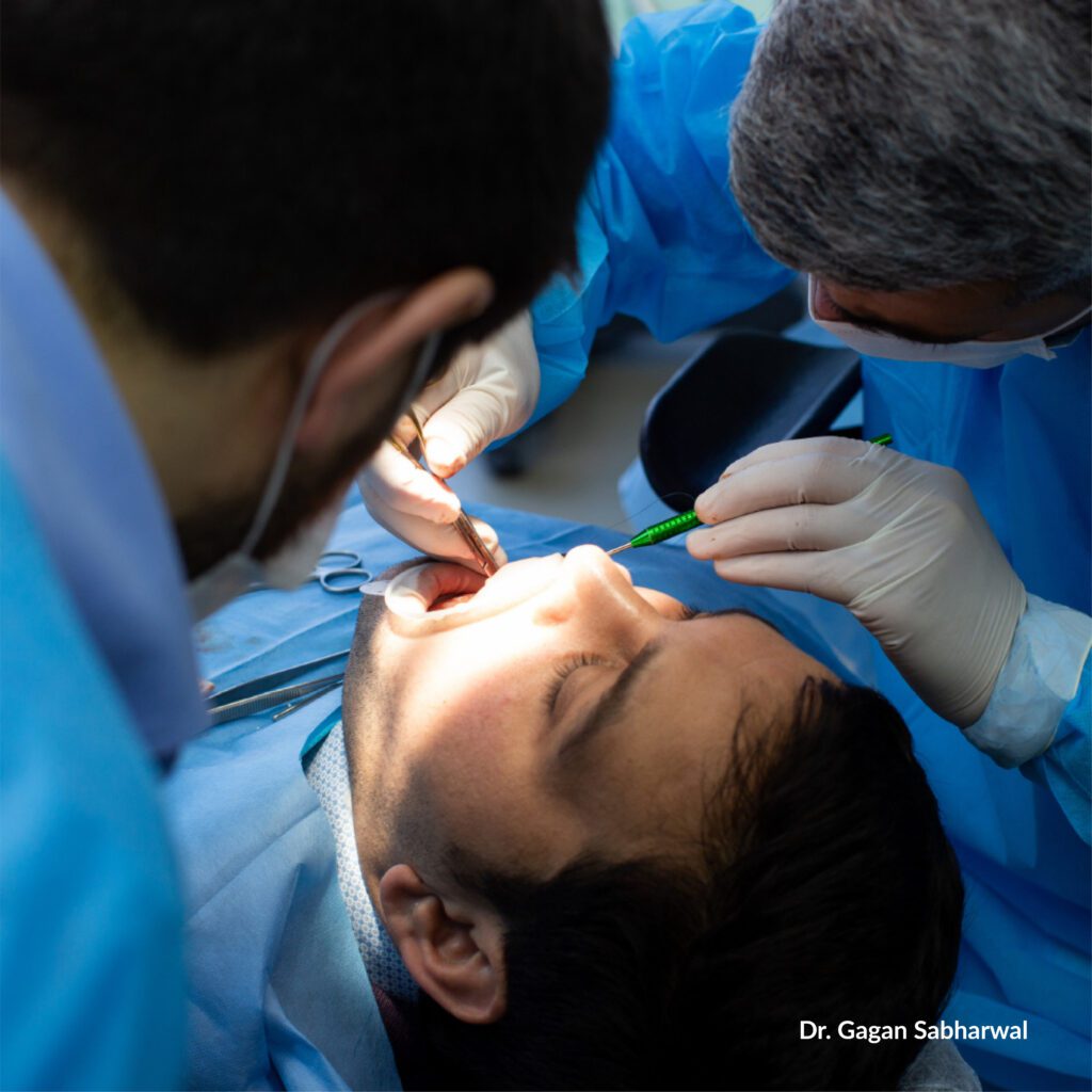 Instant dental implants