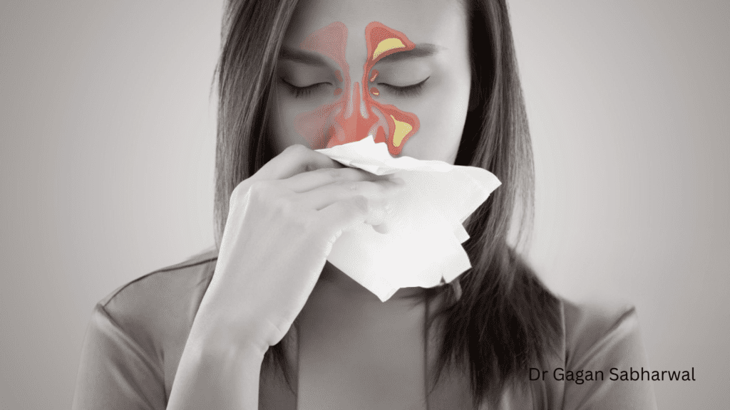 sinus lift, bone grafting surgery