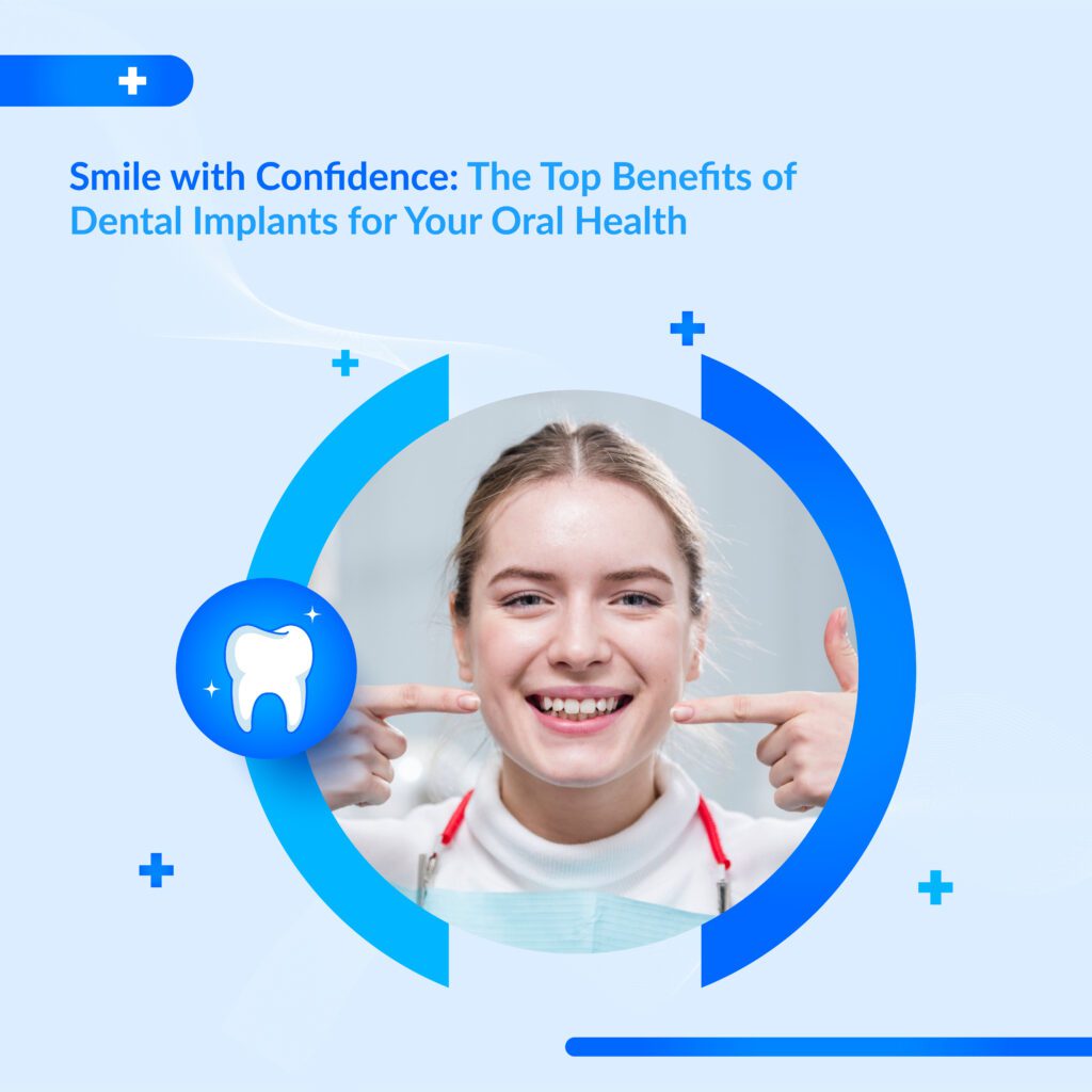 Top Benefits of Dental Implants for Oral Health