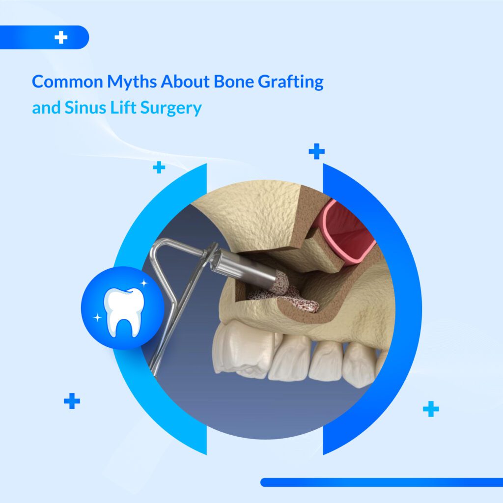 Sinus Lift Specialist UAE