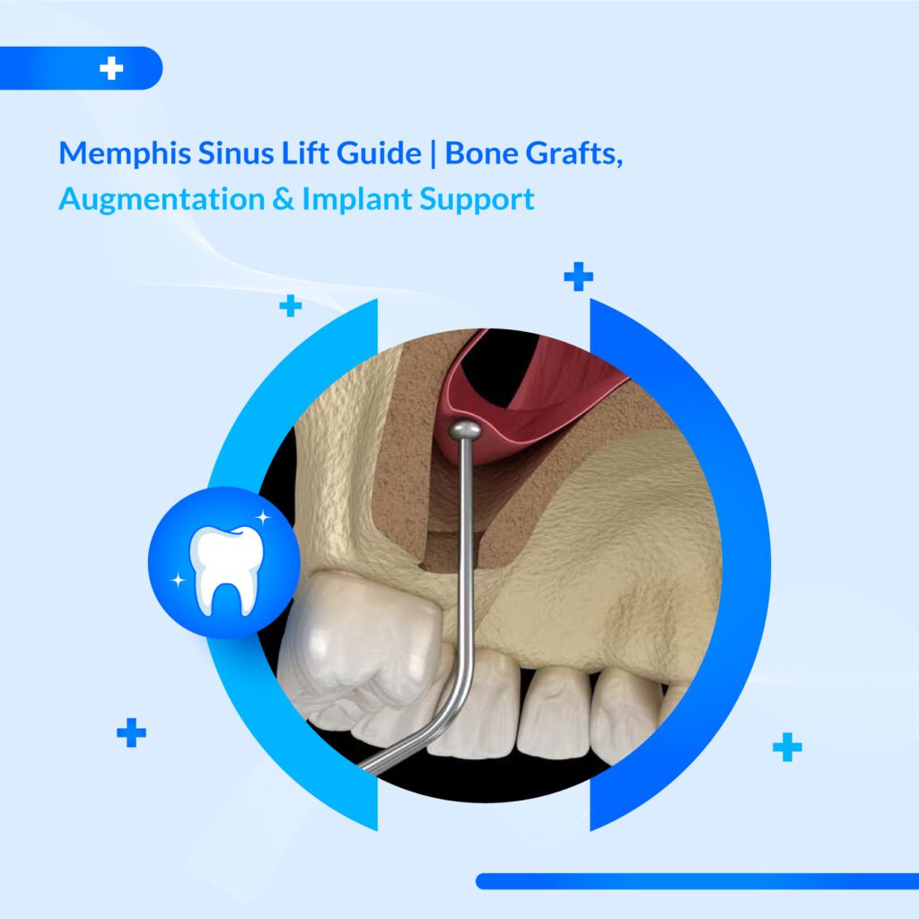 Memphis Sinus Lift & Bone Graft | Implant-Ready Jaw Support