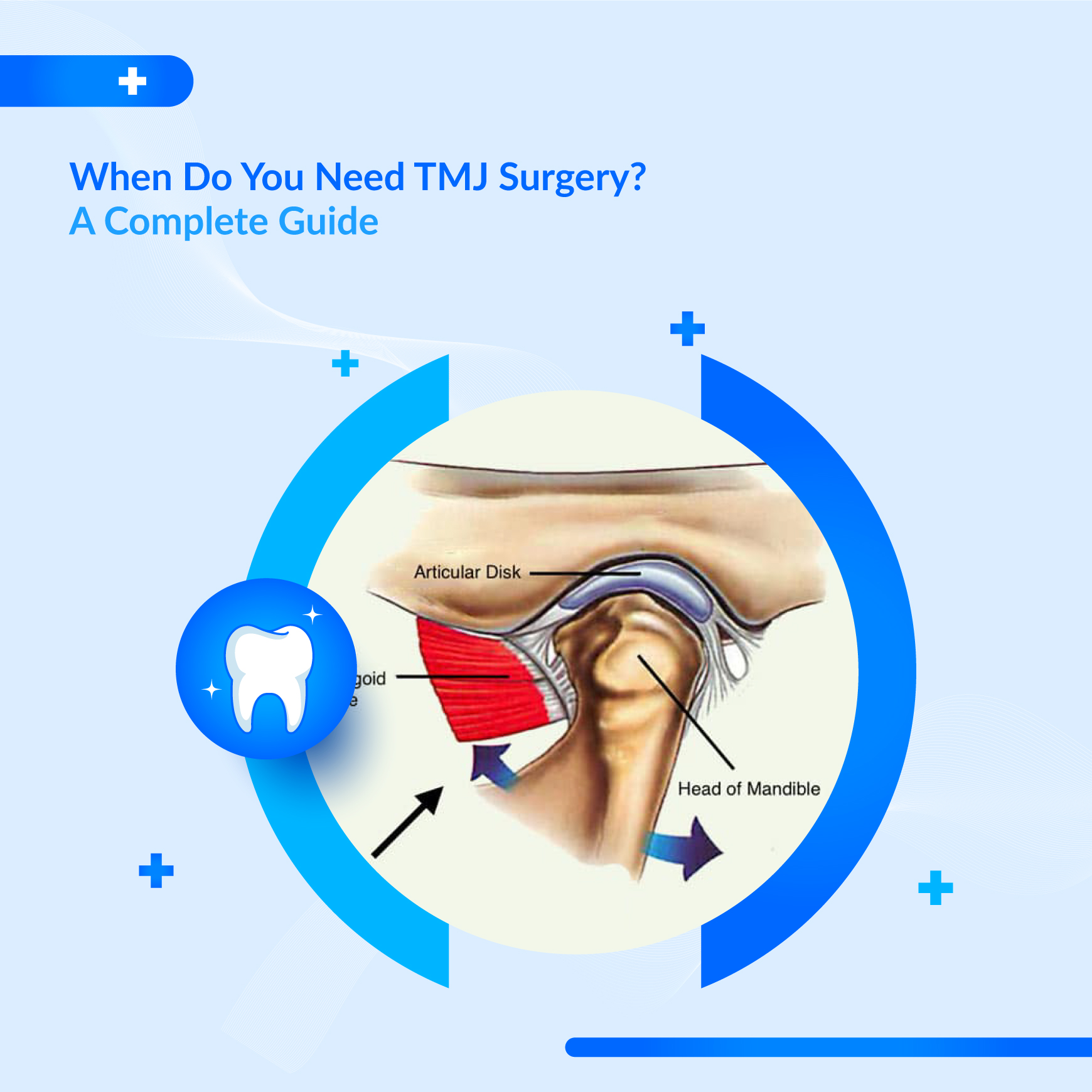 When Do You Need TMJ Surgery? | Complete Guide