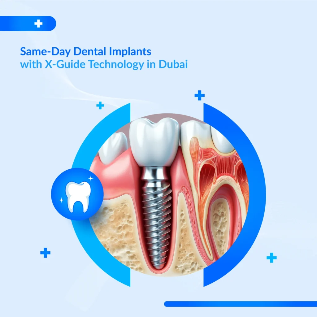 X-Guide guided implant surgery