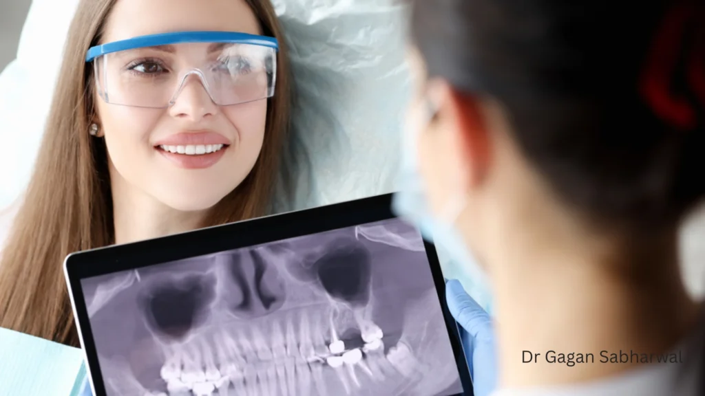 Minimally invasive dental implants Dr Gagan Sabharwal