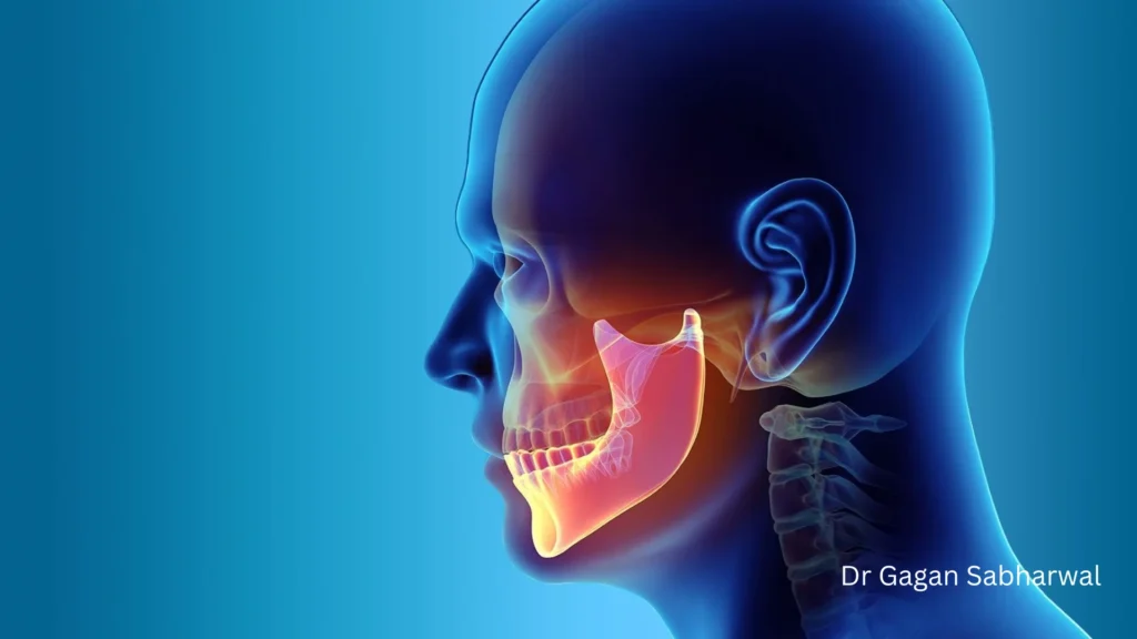 TMJ treatment in Dubai Dr Gagan Sabharwal