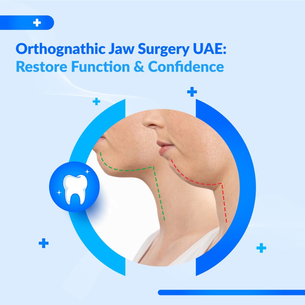 orthognathic jaw surgery UAE