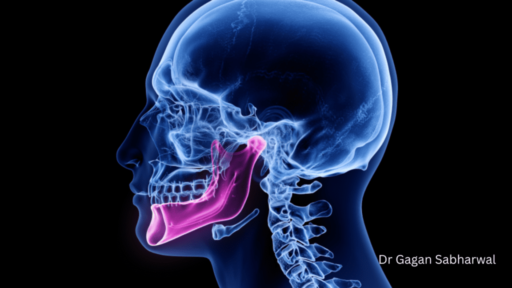 jaw pain relief UAE Dr gagan Sabharwal