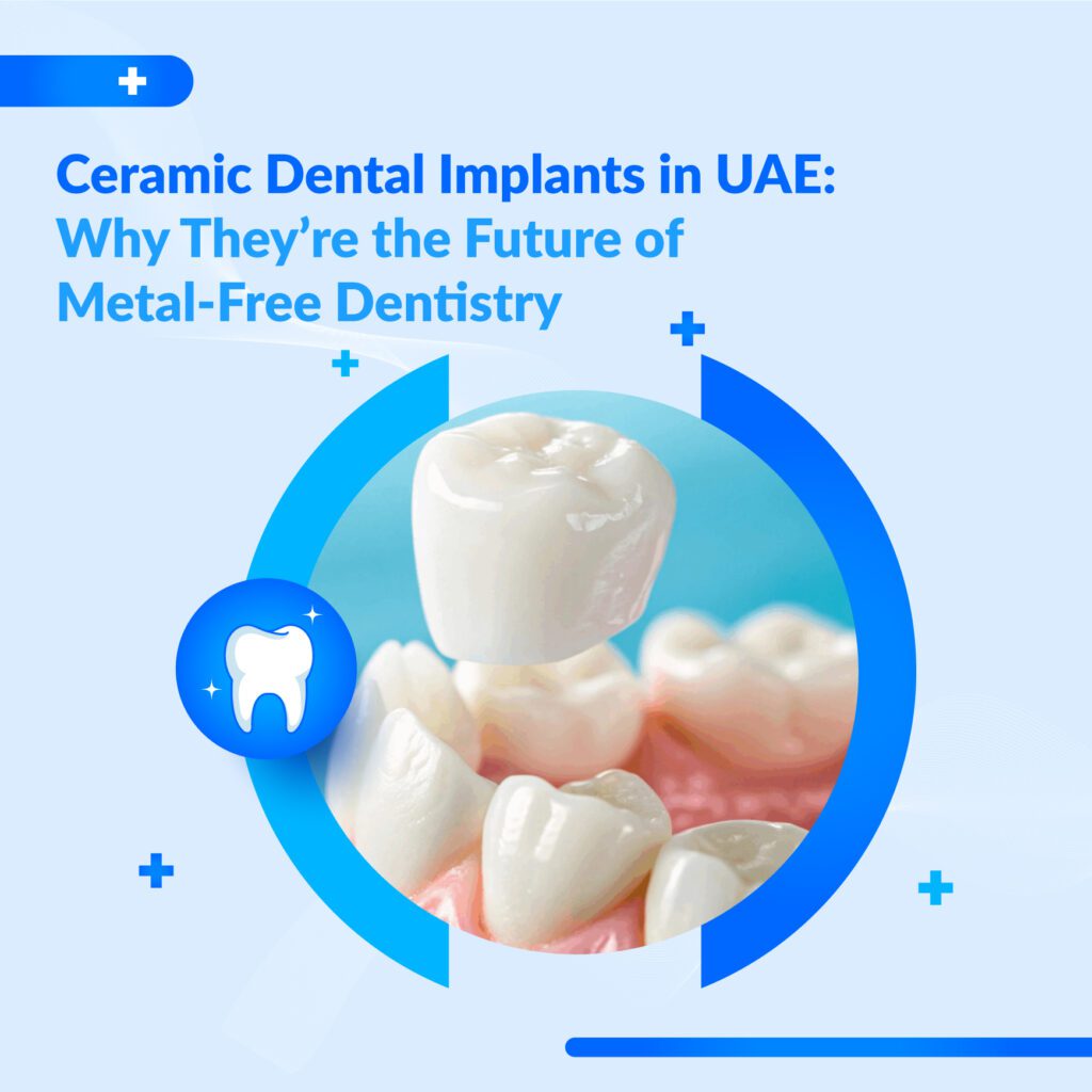 ceramic dental implants UAE