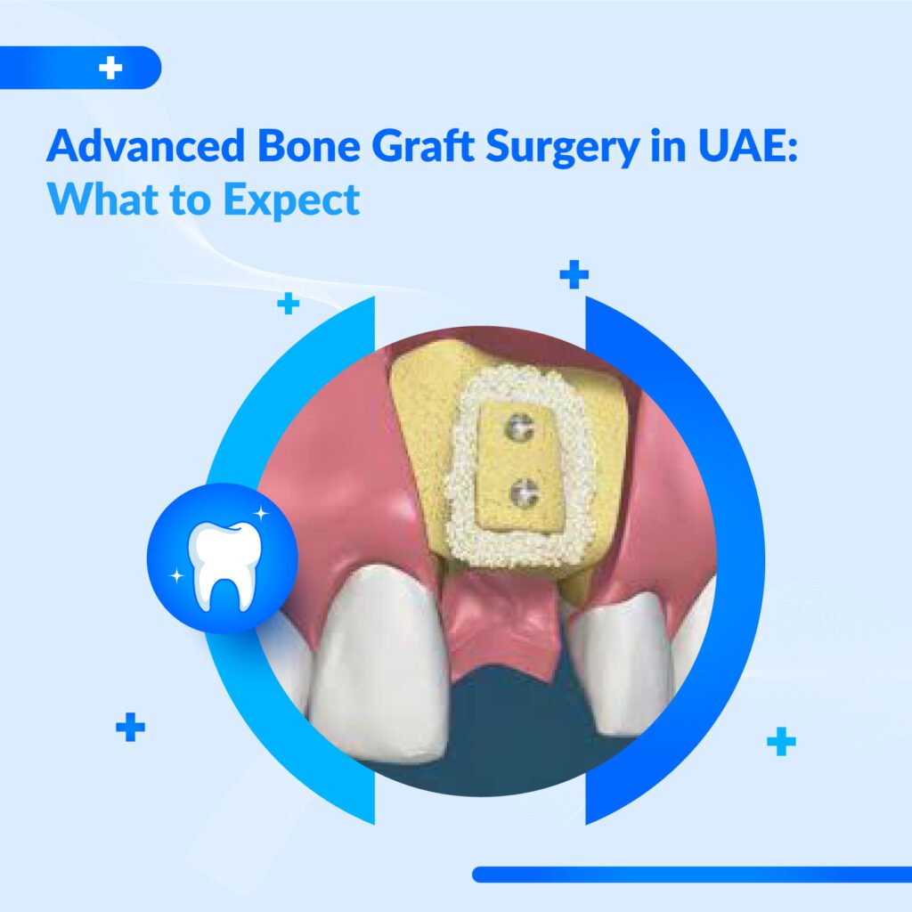dental bone graft UAE