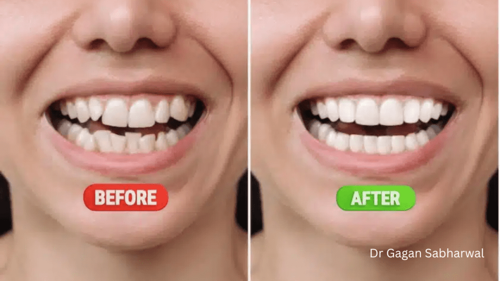 jaw alignment surgery