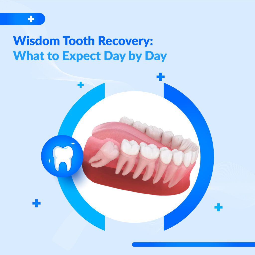 Wisdom Tooth Surgery Dubai