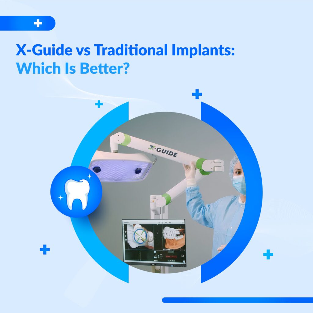X-NavTech Guided Implant Surgery Dubai