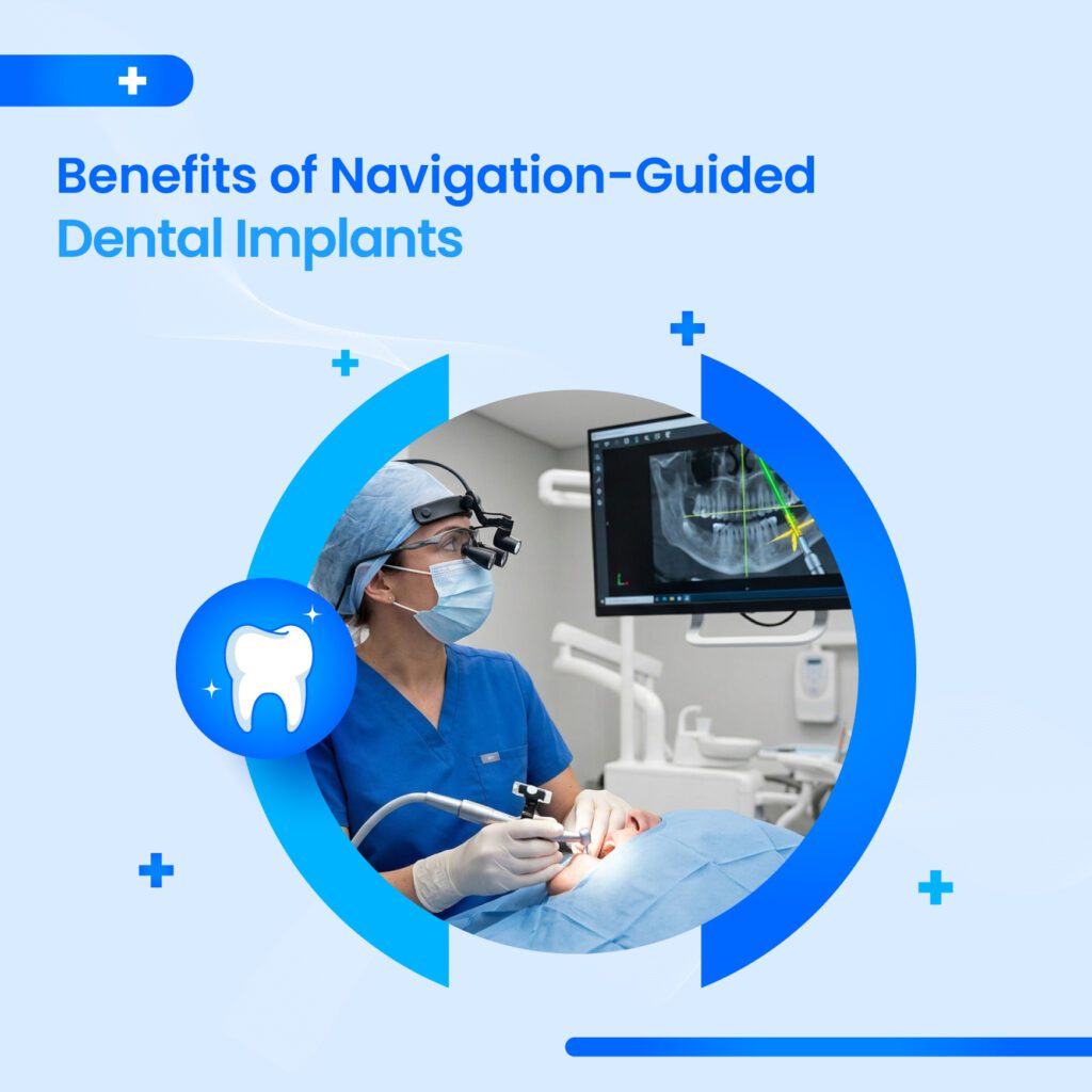 Navigation-guided dental implants