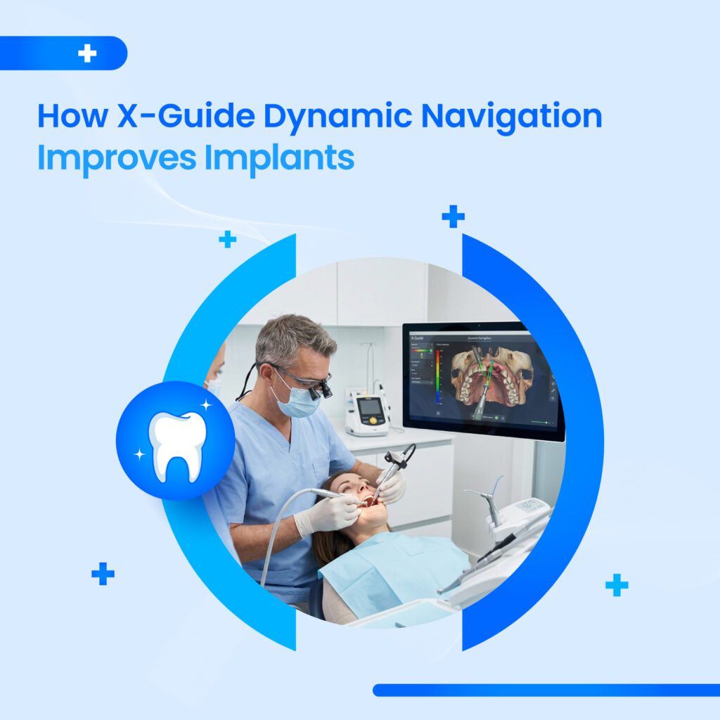X-Guide dynamic navigation