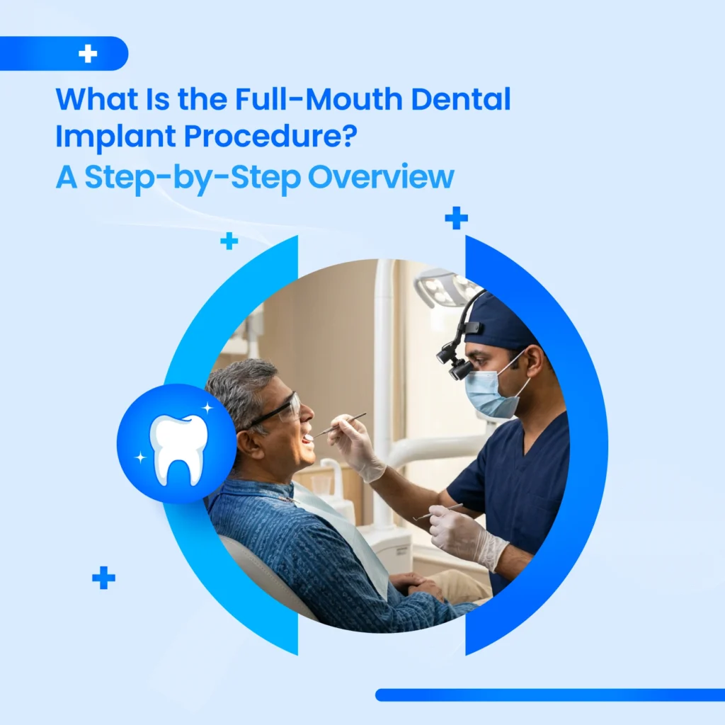 Full Mouth Dental Implants Dubai